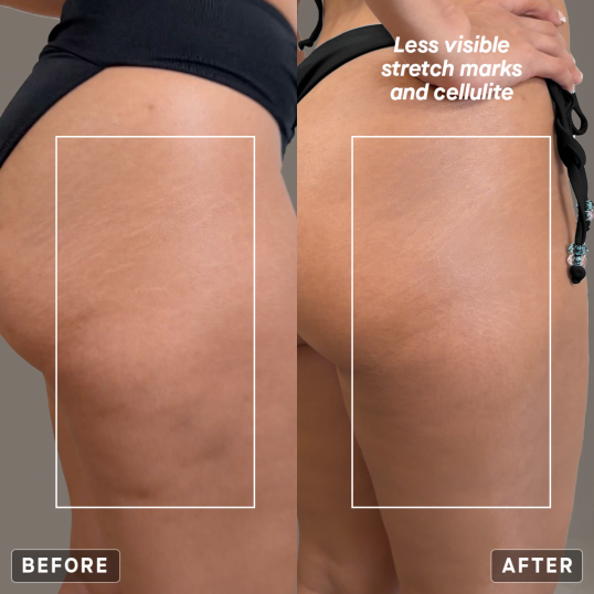 POWER BODY X - TIGHTENING & FIRMING CREAM | IL MAKIAGE