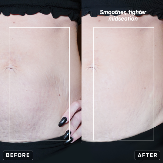 POWER BODY X - TIGHTENING & FIRMING CREAM | IL MAKIAGE