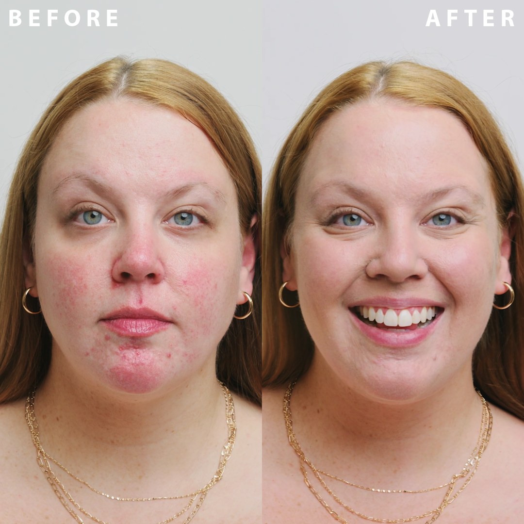 Power Camo Redness Defense video