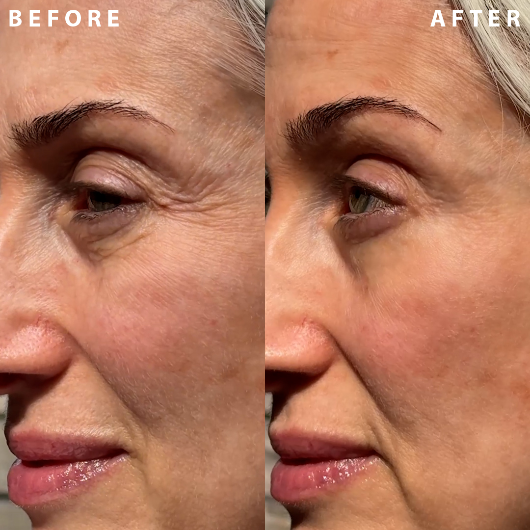 Power Redo Wrinkle Fix | IL MAKIAGE